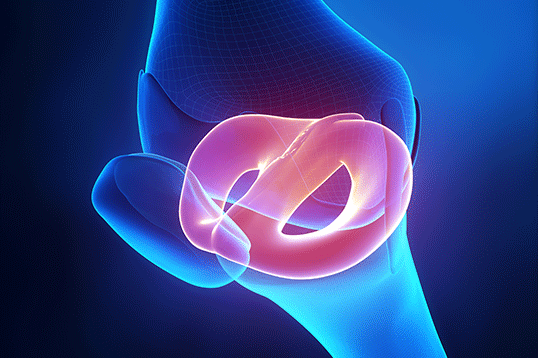 Herstel meniscus klachten
